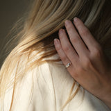 MIRU ring